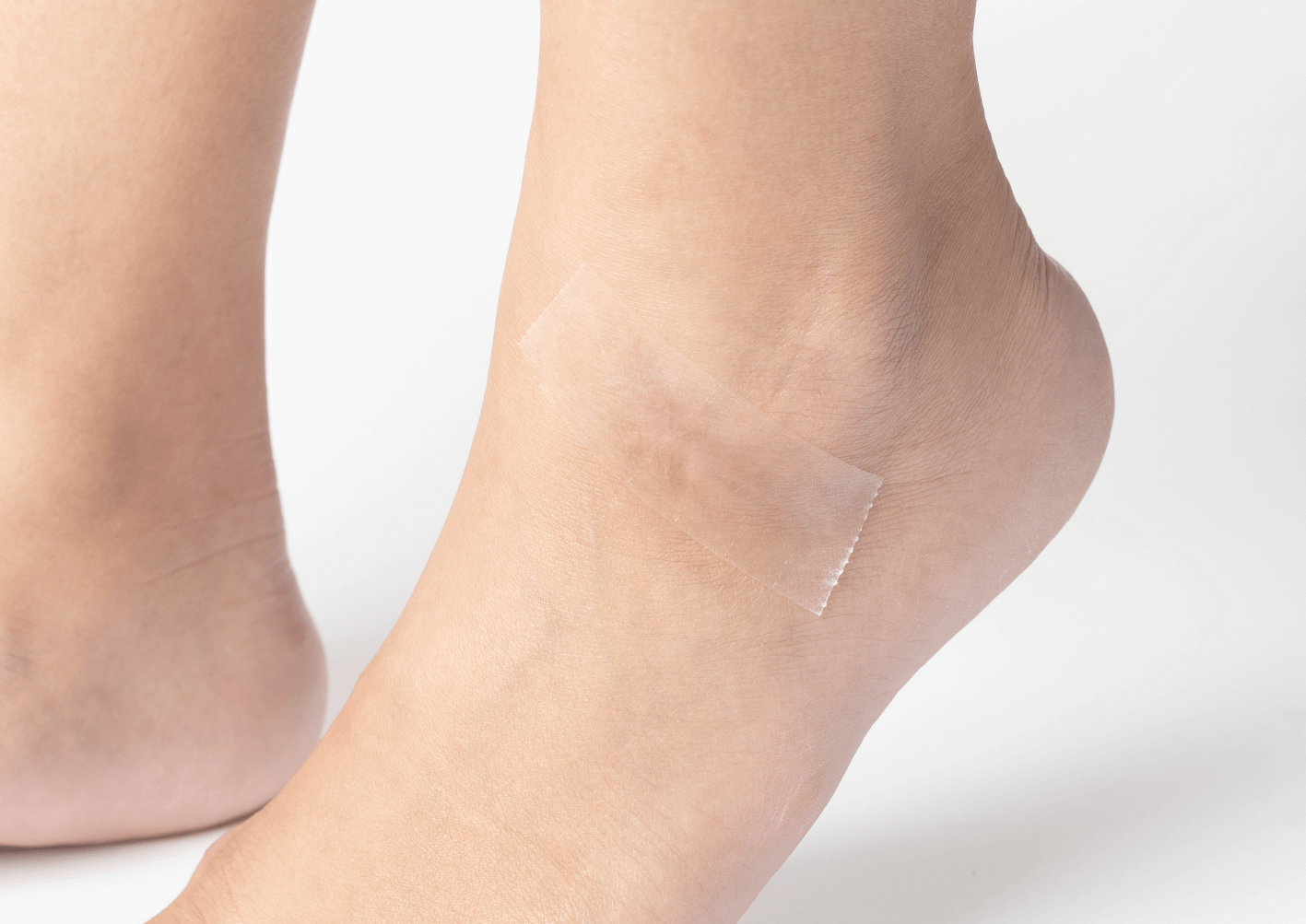 Silicone Scar Tape