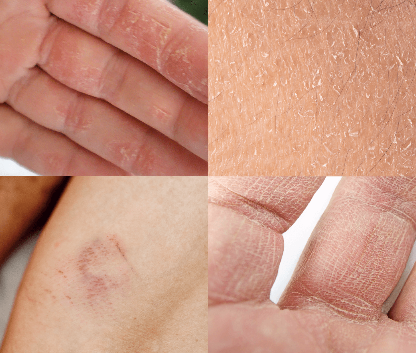 Spray Protector de Piel